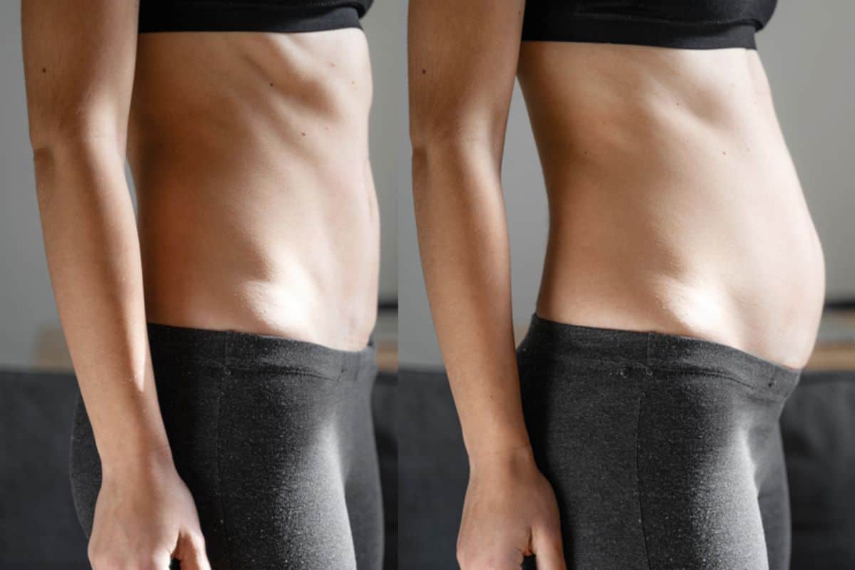 How long does diastasis recti take to improve Nantwich?