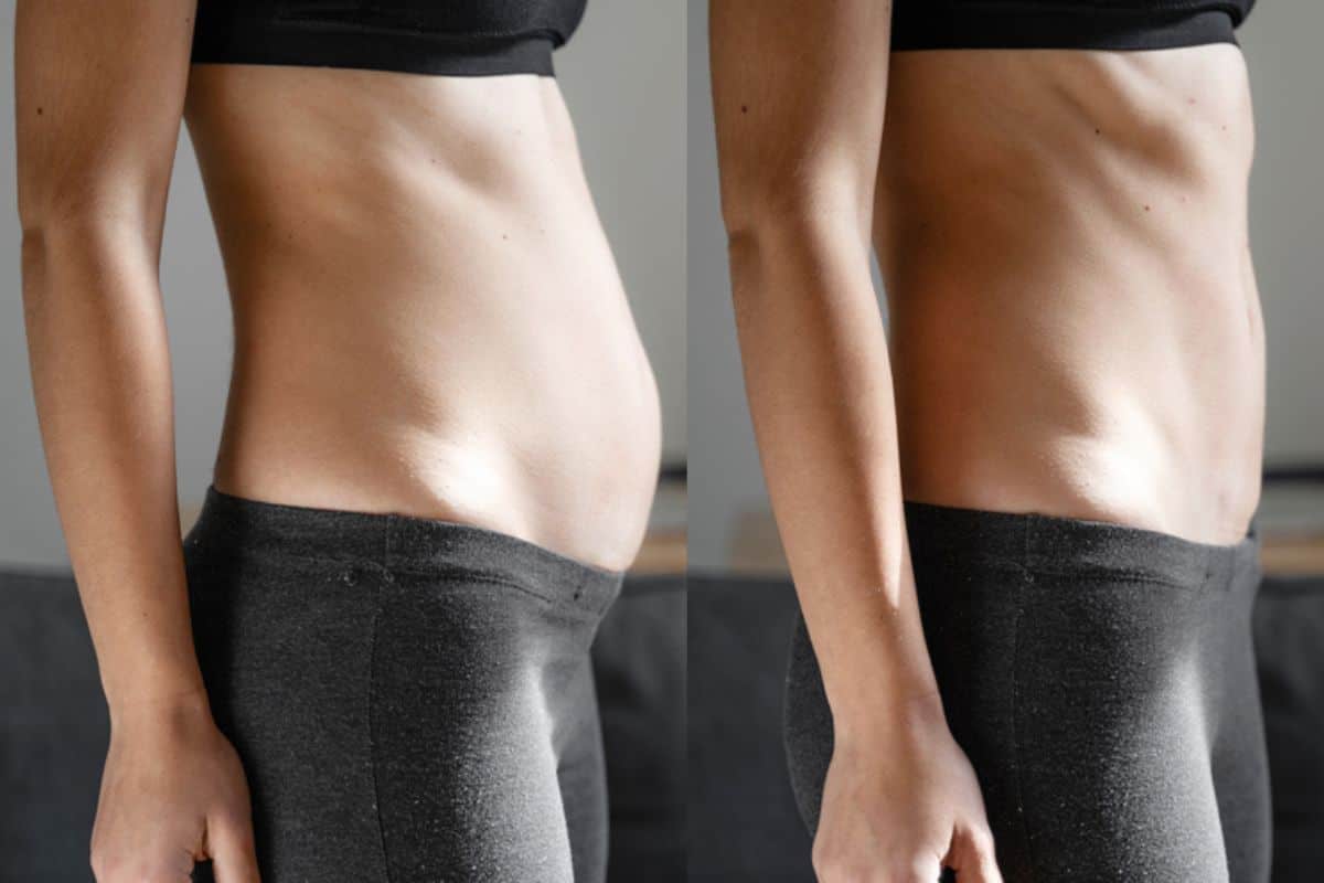 Post-Pregnancy: What Happens to Your Abdominal Muscles After Birth Nantwich