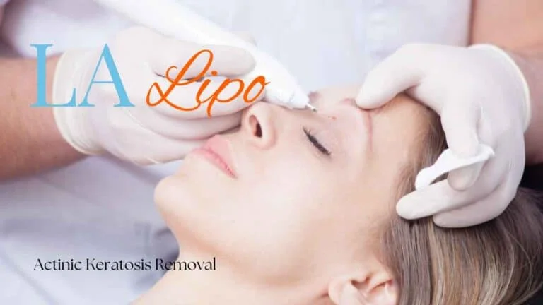 Woman receiving Actinic Keratosis Removal Treatment Nantwich
