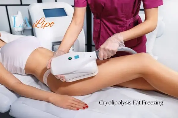 Woman receiving coolsculpting Nantwich treatment on her thighs