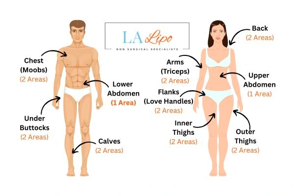 LA LIPO Cryolipolysis Areas Nantwich