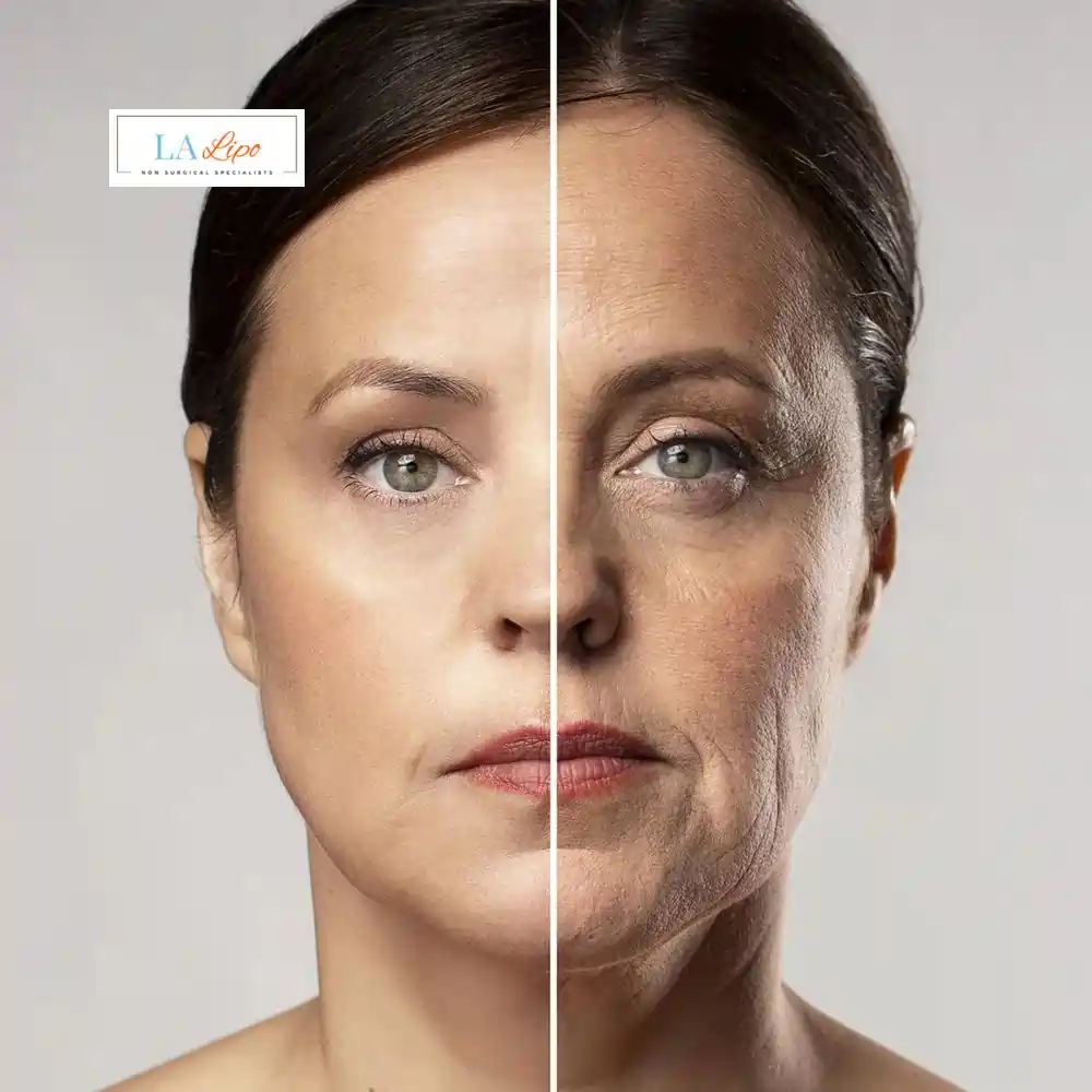 How Can You Tell If Non-Surgical Skin Tightening Is Right for You Nantwich?