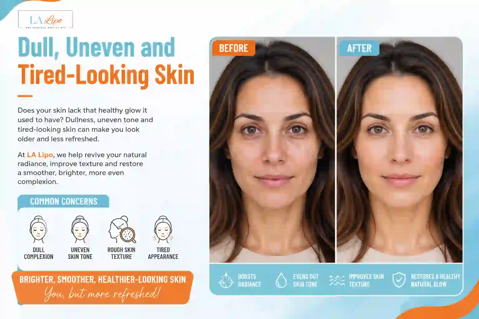 Sign #5: Dull, Uneven and Tired-Looking Skin Nantwich