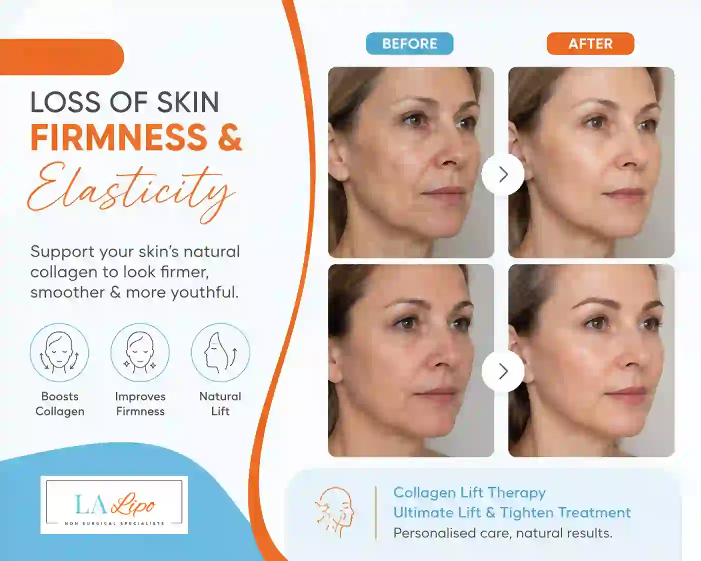 Sign #7: Loss of Skin Firmness and Elasticity Nantwich