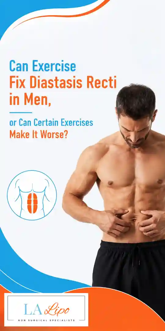 Can Exercise Fix Diastasis Recti in Men, or Can Certain Exercises Make It Worse Nantwich?