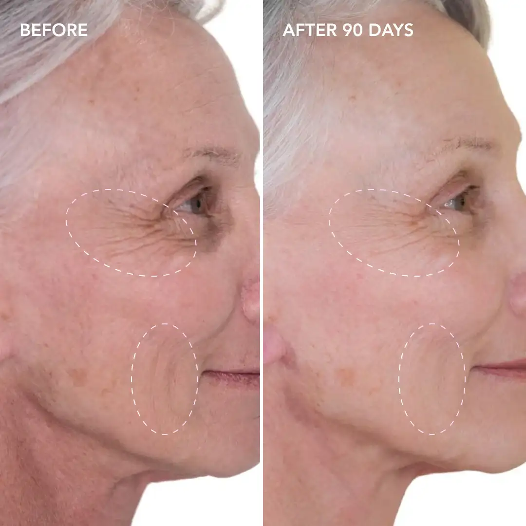 When will you see results Nantwich